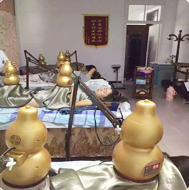艾和葫芦灸理疗
