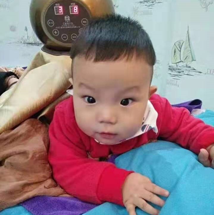 儿童案例