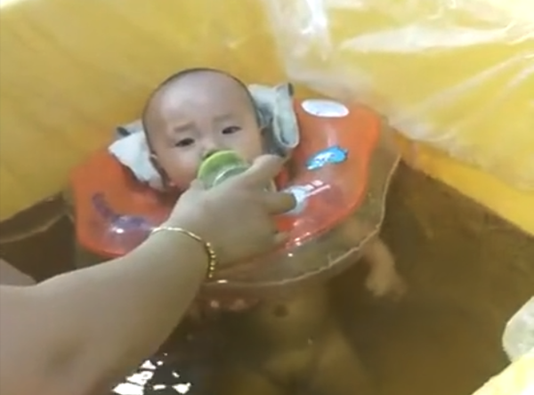 儿童艾浴泡案例