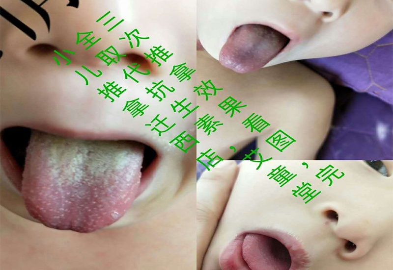 康复案例展示