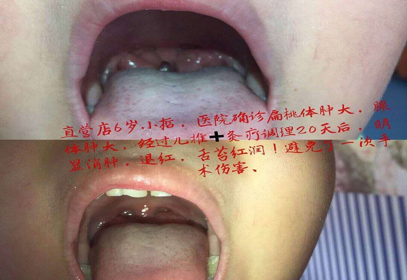 儿童案例展示