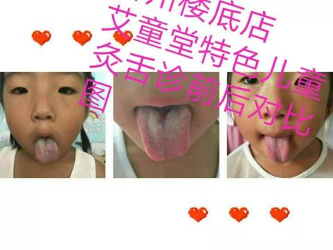 艾童灸法8