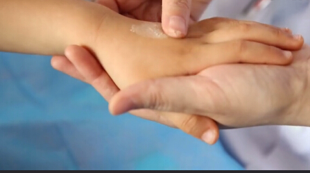 艾童堂，石家庄小儿推拿，葫芦灸